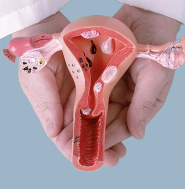 Ovarian Cancer Symptoms: Early Warning Signs You Shouldn’t Ignore